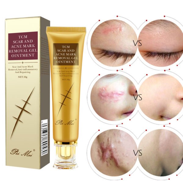 Light Scar Cream Scar Fine Grain Desalination Skin Care Products - Image 6